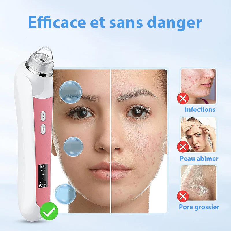 Aspirateur Point Noir avec Camera - Extracteur de Comédons & Nettoyeur de Pores Professionnel – Image 2